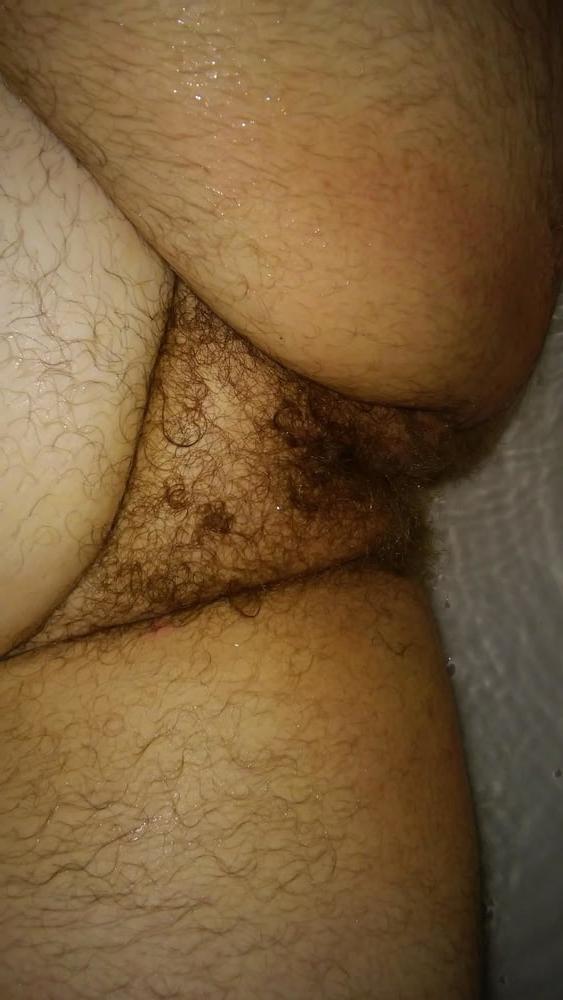 25P Stunning Hairy BBW Pussys