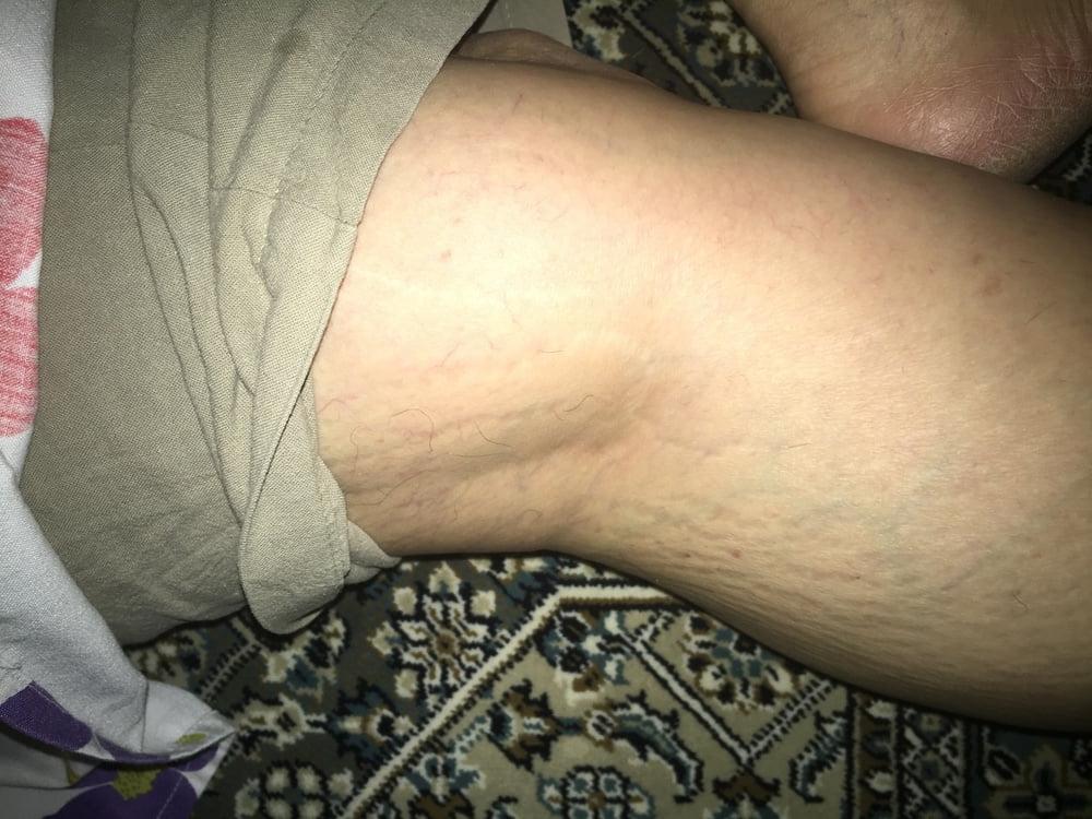 23P Legs
