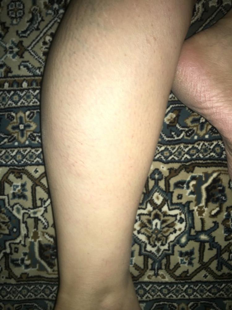 23P Legs