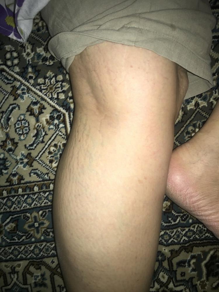 23P Legs