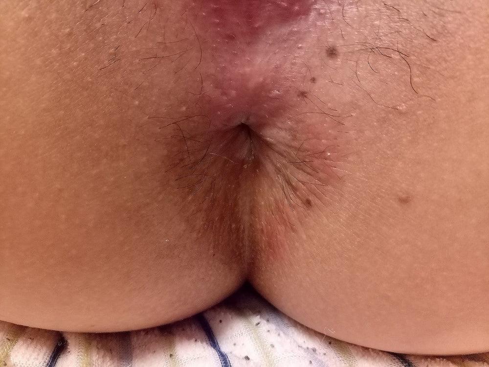 17P My  jp ex-gf t ass &amp; pussy