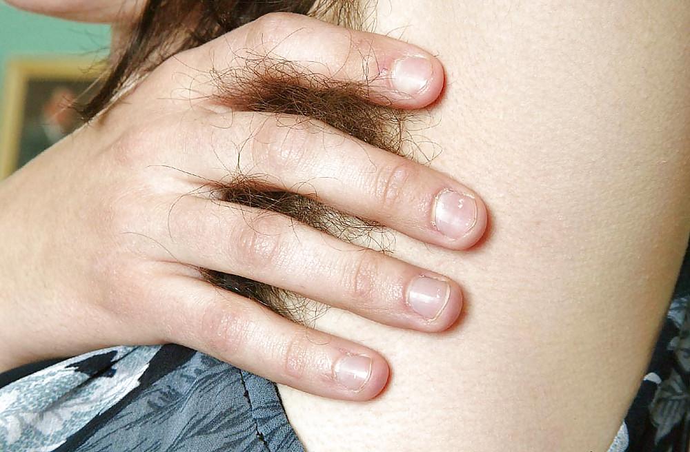 25P DO YOU LIKE HAIRY WOMAN ?...HERE IS RENEE