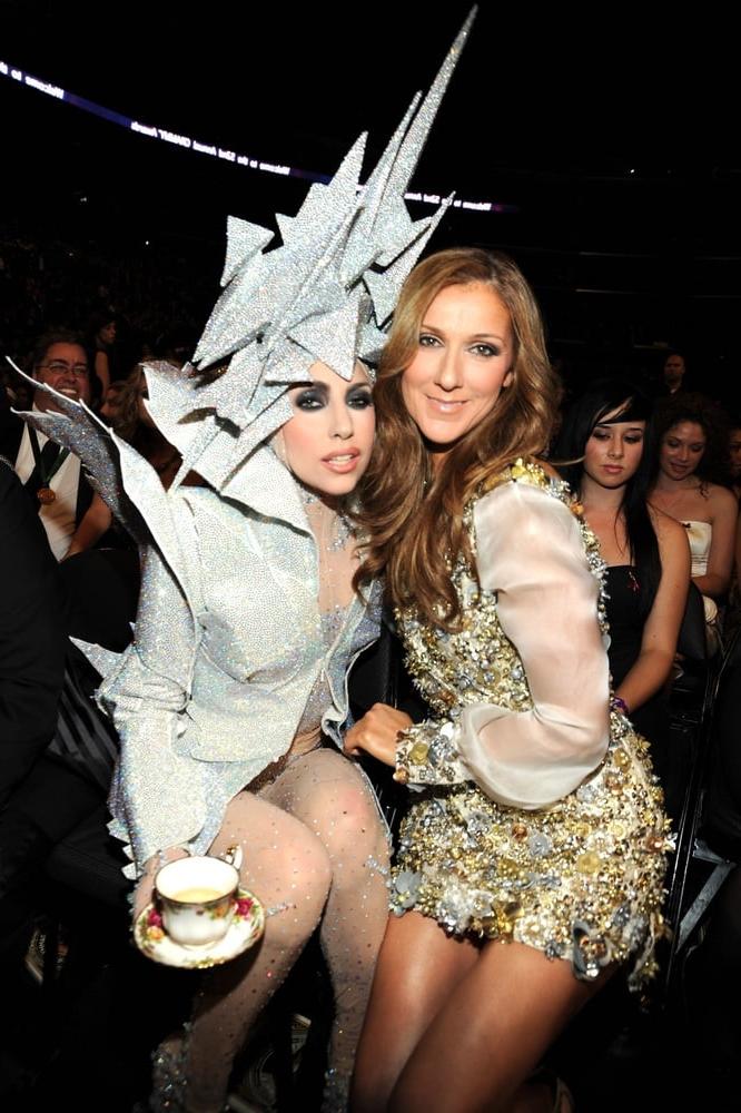 25P Celine Dion legs for days