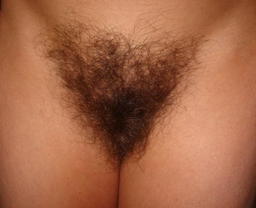 25P Hairy 9