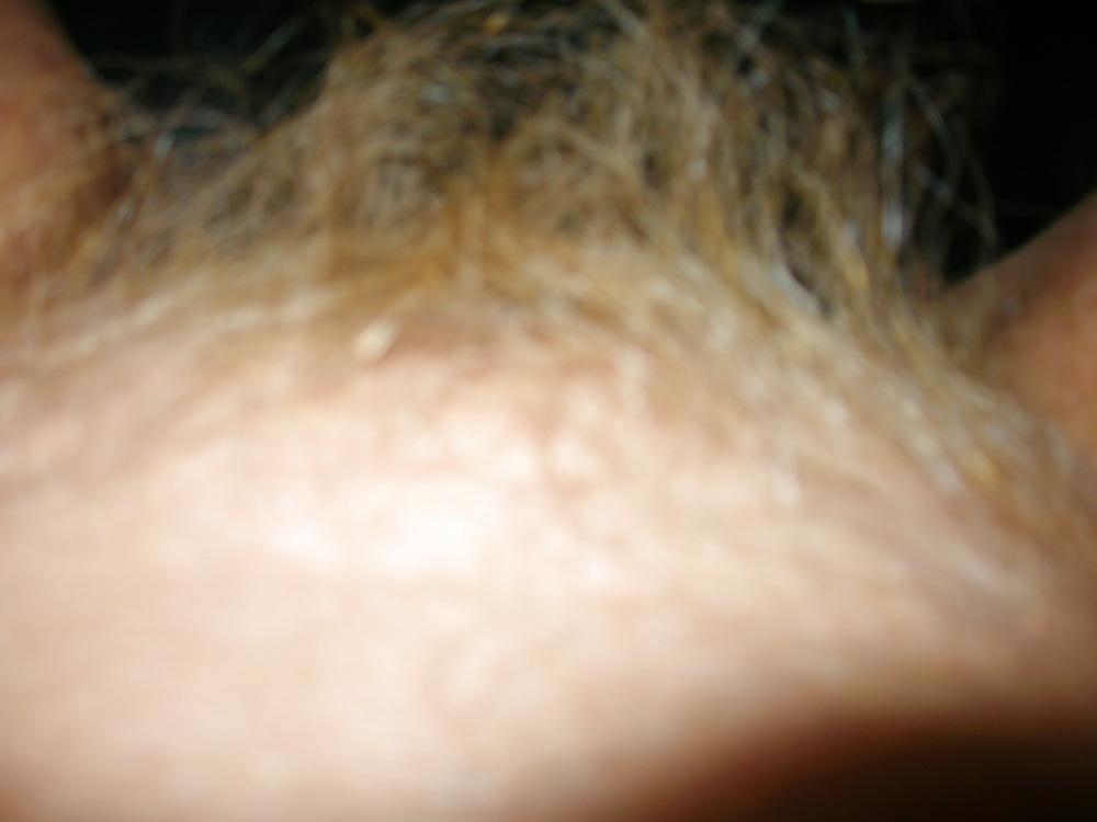 8P Ginger bush