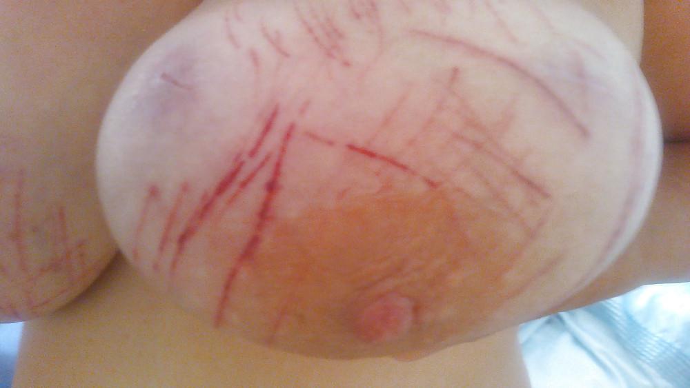 6P Scottish Slut - Sore tits
