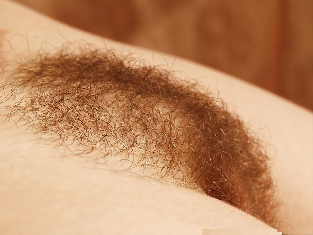 16P Hairy mouse