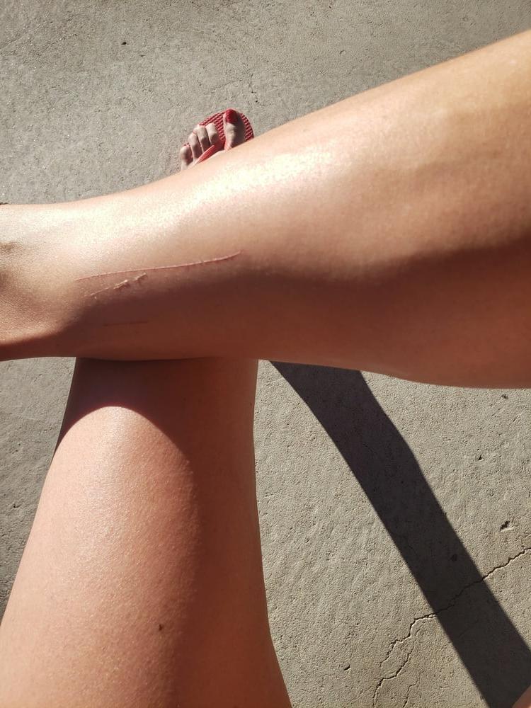 15P Legs