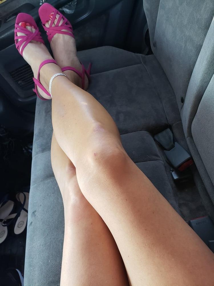 15P Legs
