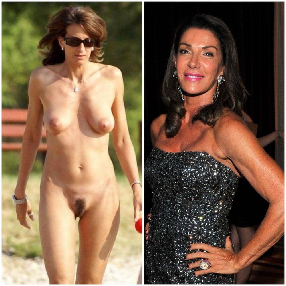20P The Best Dress - Undress Beauty part 102
