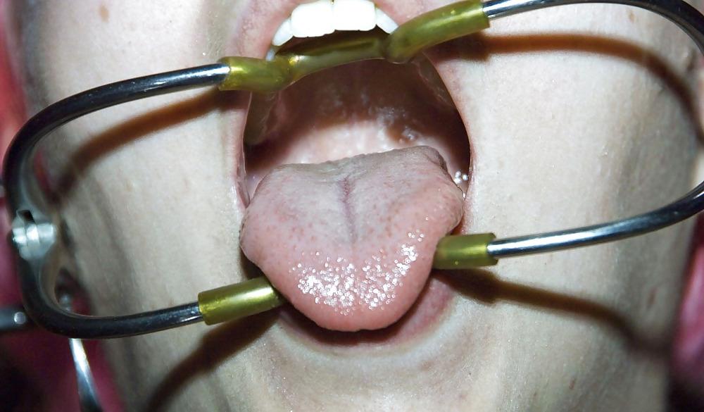 15P Cherry T DBSM Dentist Chair