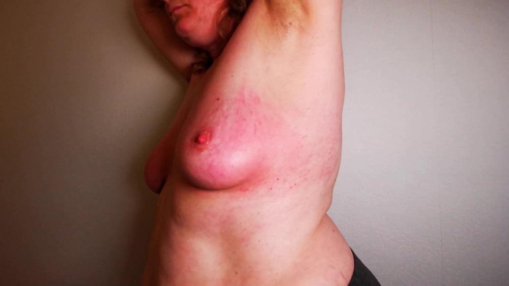 24P Hard slapping tits real red