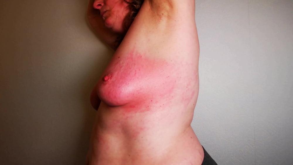 24P Hard slapping tits real red