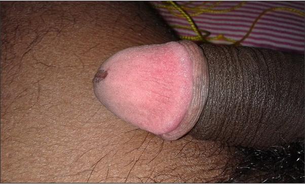 18P My Hard cock