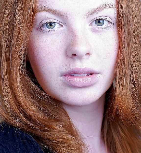 25P The Beauty Of Redheads & Freckles