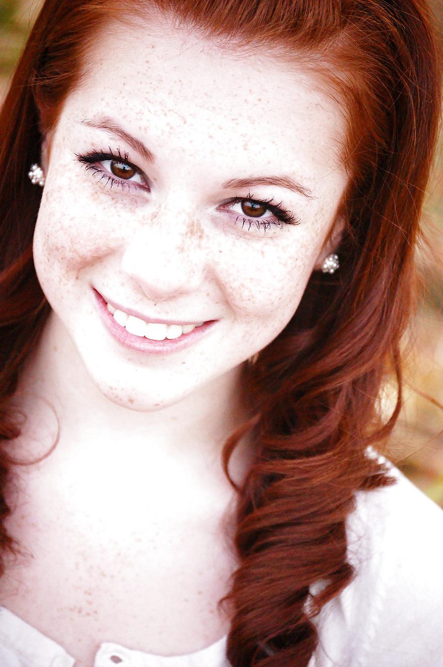 25P The Beauty Of Redheads & Freckles