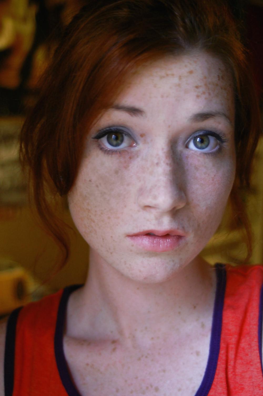 25P The Beauty Of Redheads & Freckles