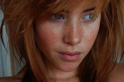 25P The Beauty Of Redheads & Freckles