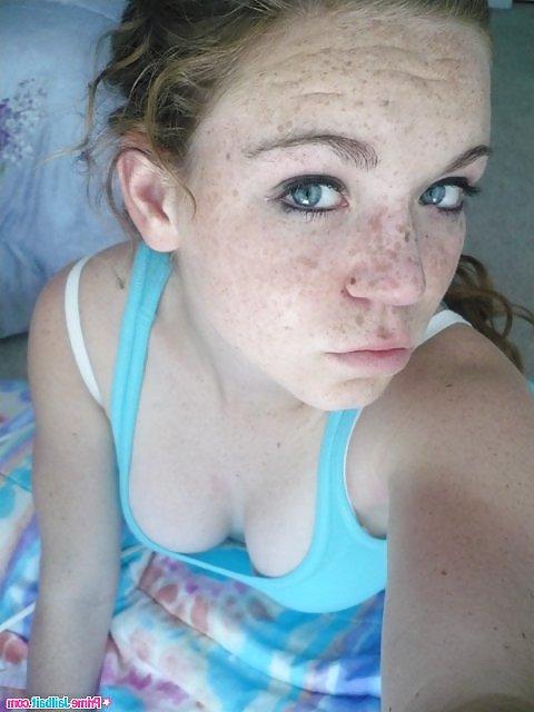 25P The Beauty Of Redheads & Freckles
