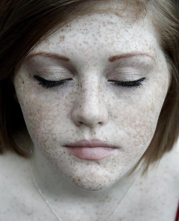 25P The Beauty Of Redheads & Freckles