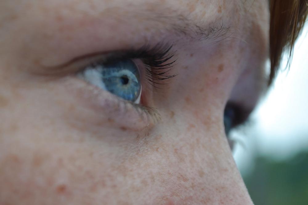 25P The Beauty Of Redheads & Freckles