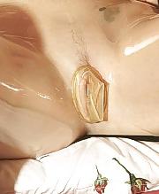 25P Female condom