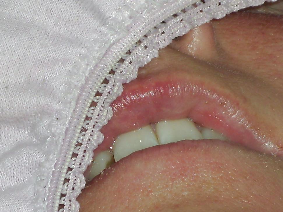 25P Wife upskirt and pantie pics