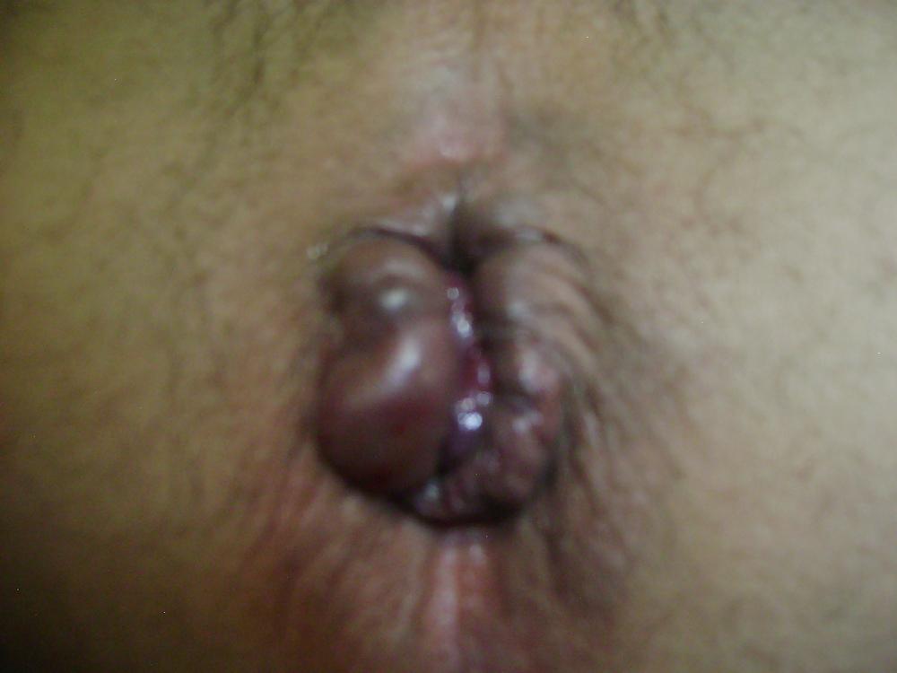 12P Lick my ass baby