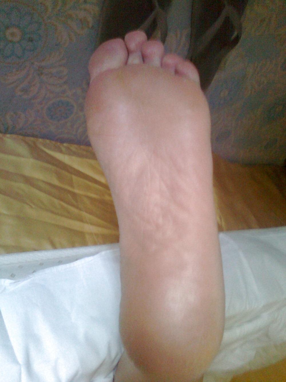 25P Old and new fres wife red pedicure