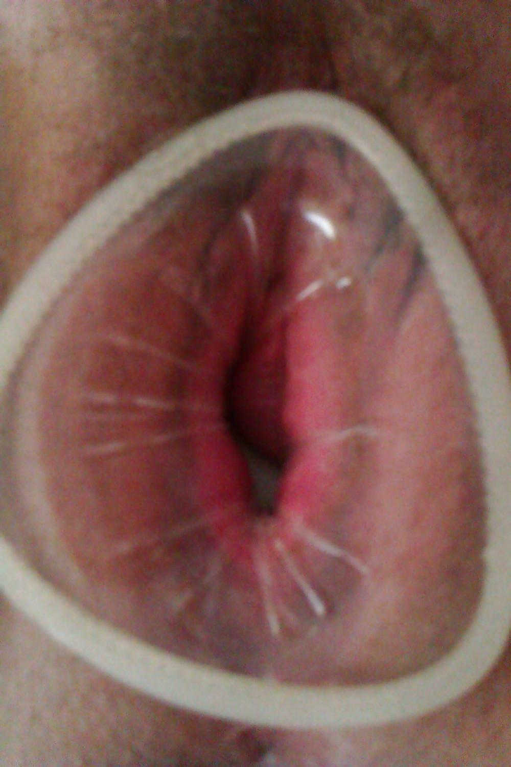 10P Female condom