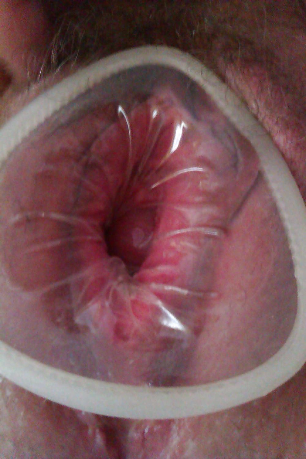 10P Female condom