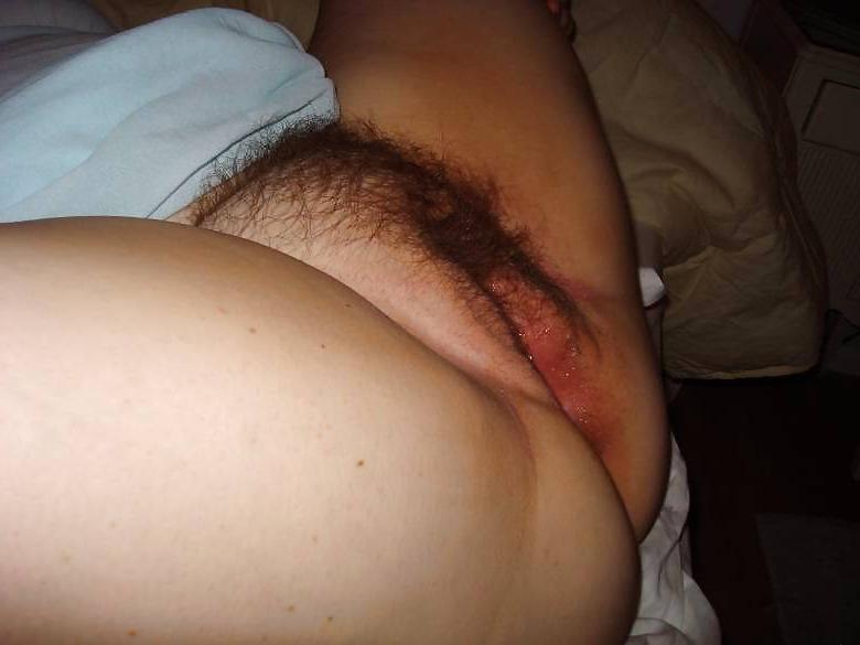 25P The Beauty of Hairy Hairy Amateurs