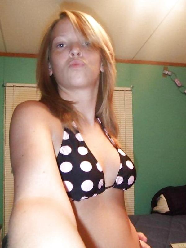 25P Hairy Pus Texas Teen