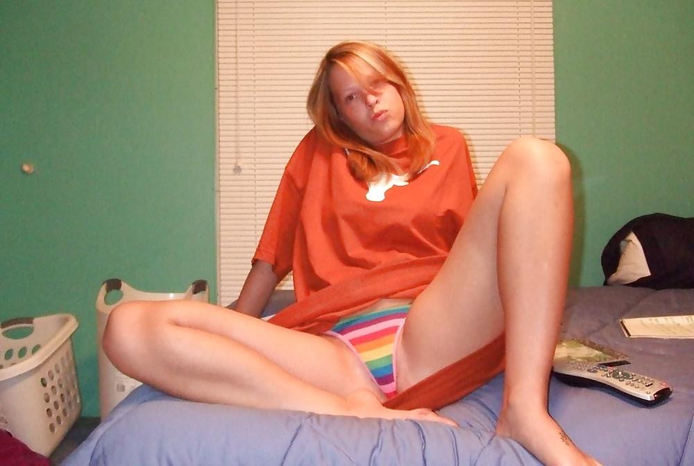 25P Hairy Pus Texas Teen
