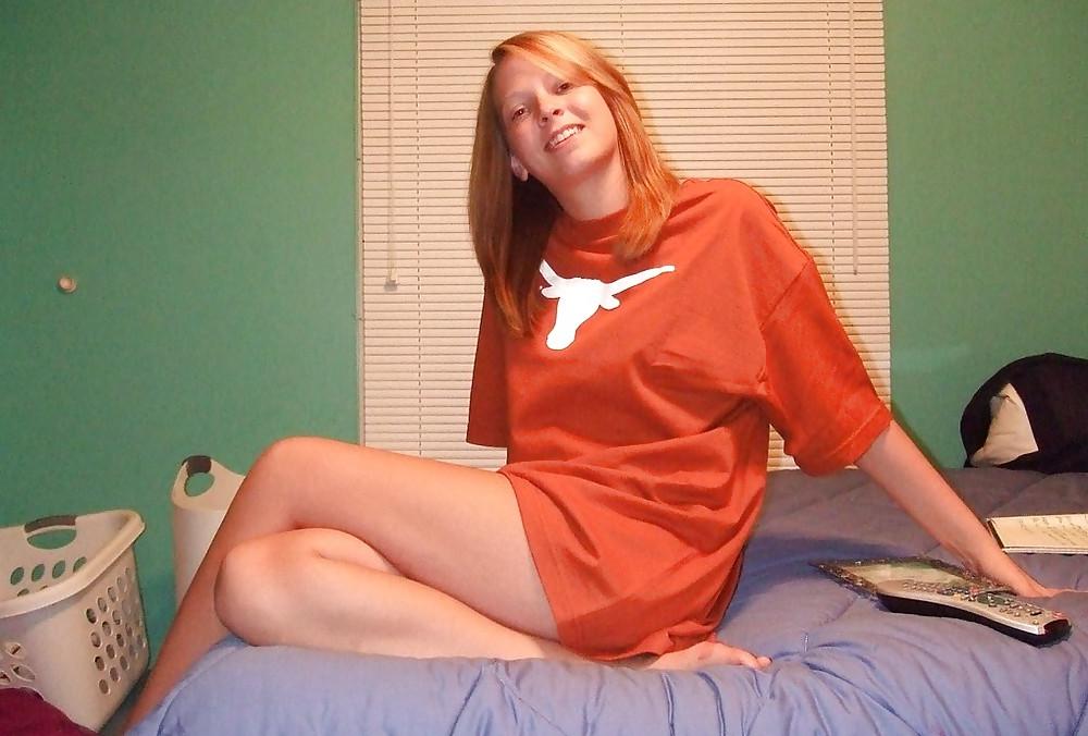 25P Hairy Pus Texas Teen