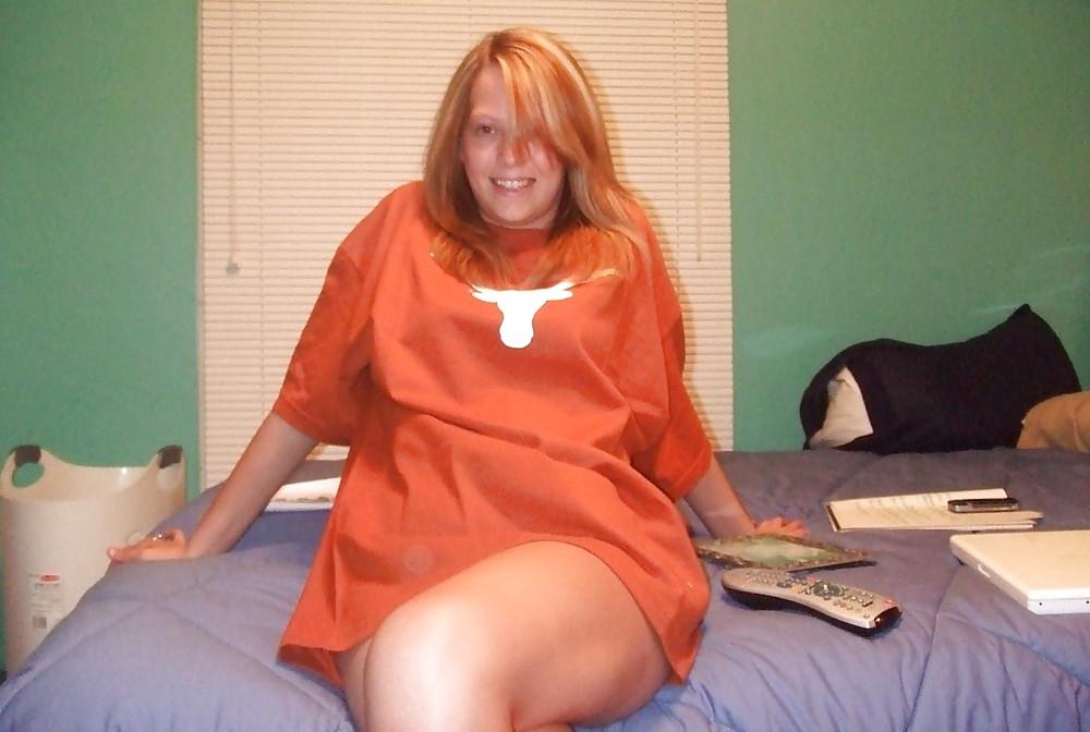 25P Hairy Pus Texas Teen