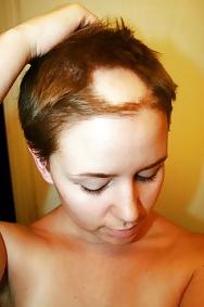 18P Shaved on top...
