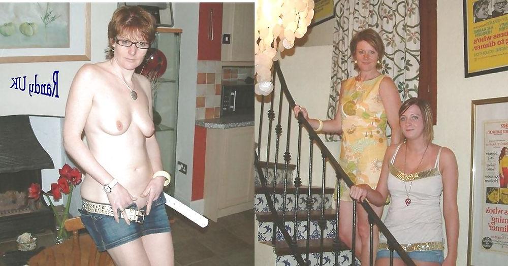 20P Before - After 35