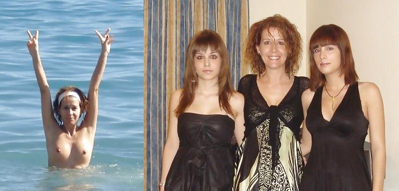 20P Before - After 35