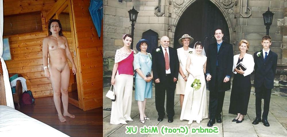 20P Before - After 35