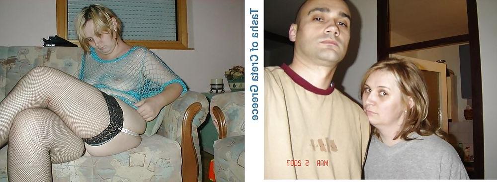 20P Before - After 35
