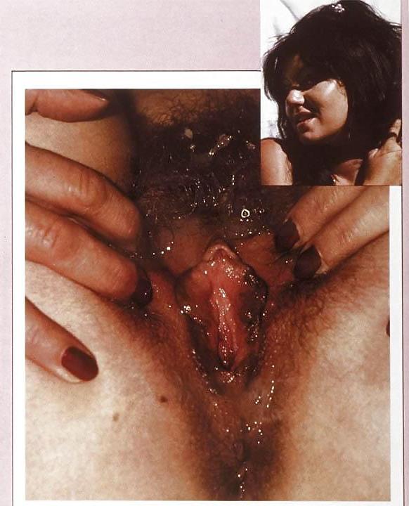 25P Cunt Contest