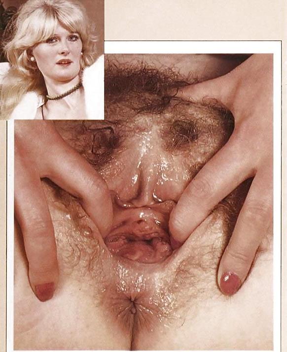 25P Cunt Contest