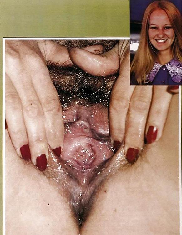 25P Cunt Contest