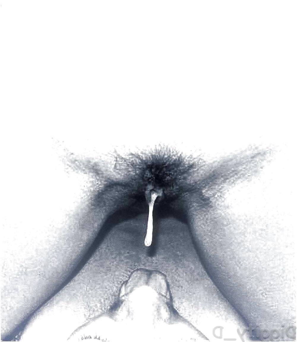 11P Self-shot Erotica