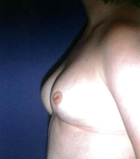 14P The Beauty of Fucked Up Tits Big and Small