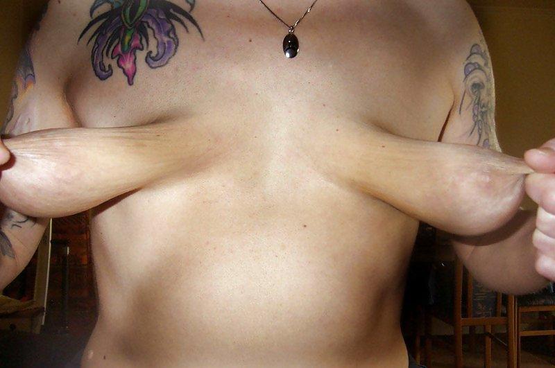 18P The Beauty of Fucked Up Tits Big and Small