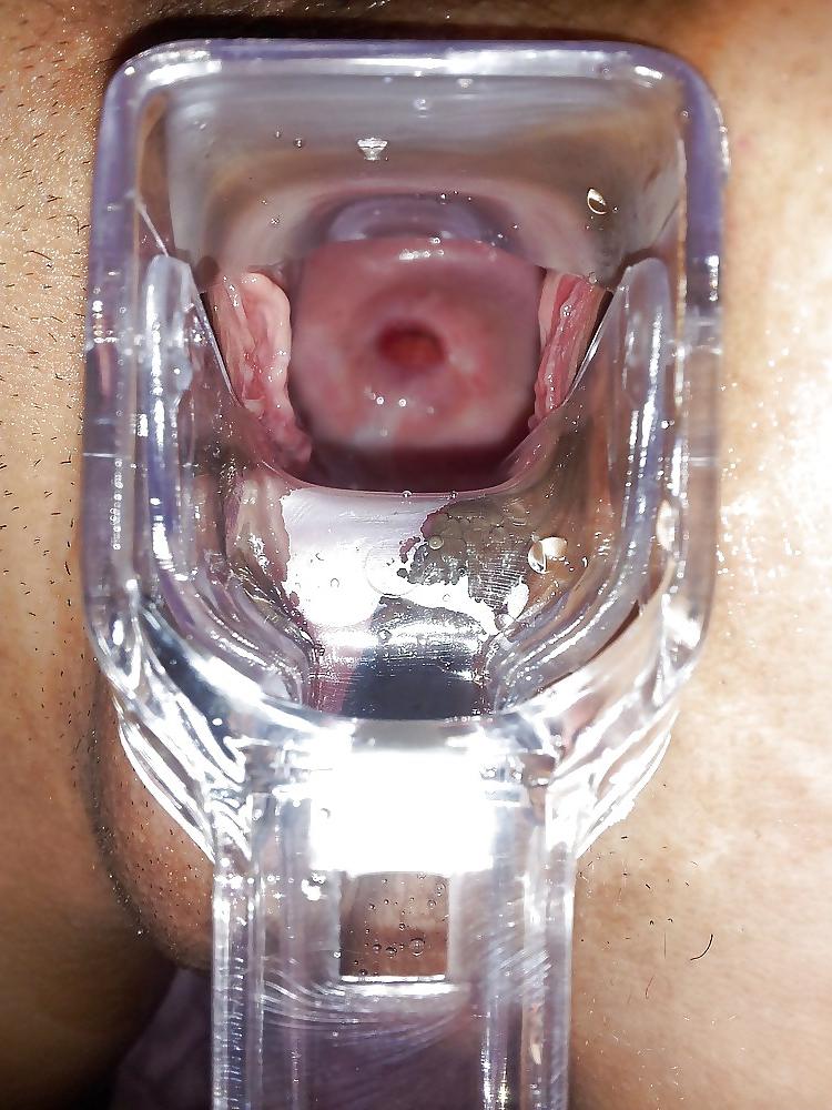4P Cervix, speculum, open wide pussy