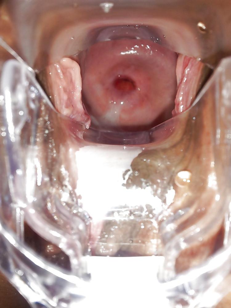 4P Cervix, speculum, open wide pussy