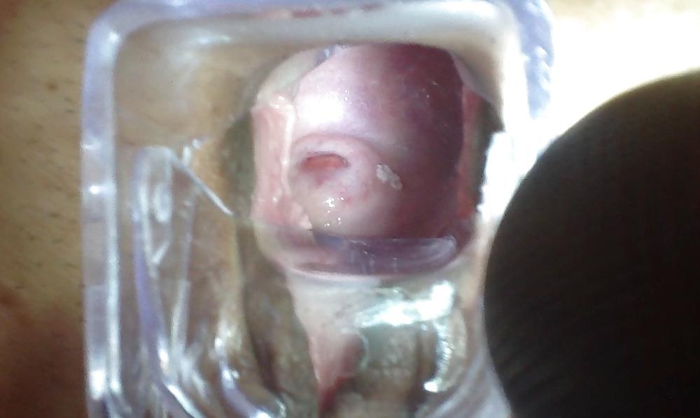 4P Cervix, speculum, open wide pussy